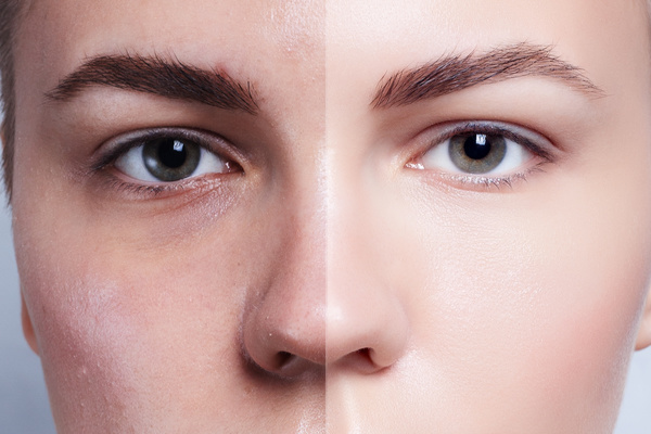 Face Aesthetic